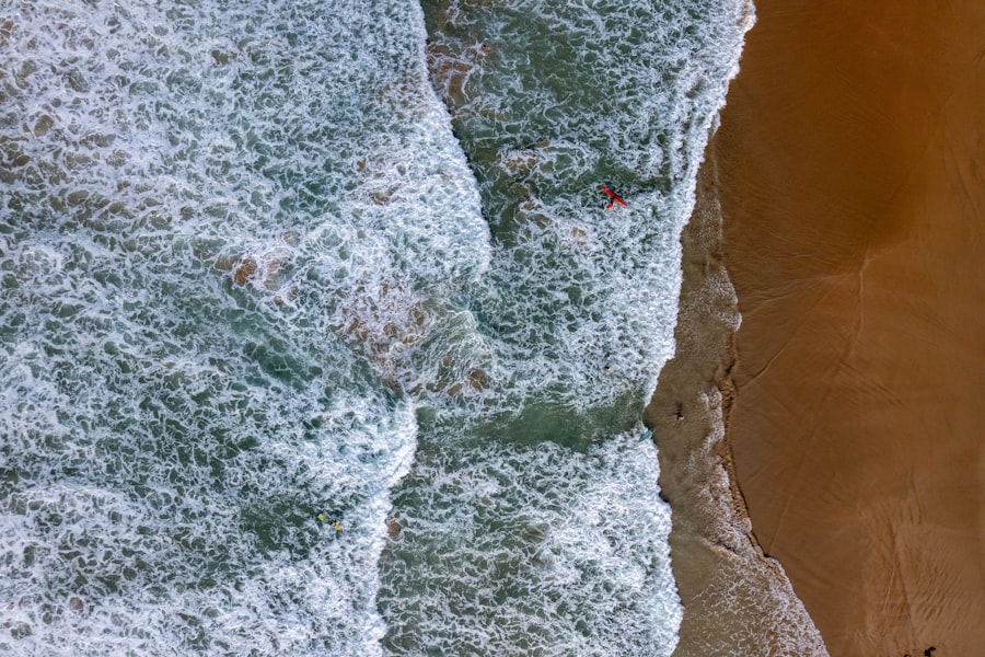 Photo botox nasolabial folds