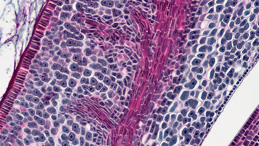 Photo trapezius muscle botox